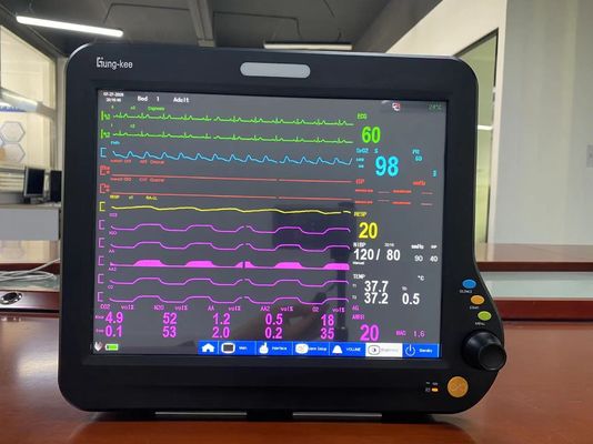 มอนิเตอร์หัวใจในห้อง ICU ของผู้ป่วยทารก